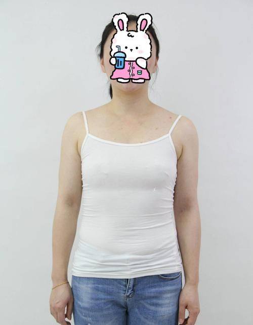 佳木斯市向阳区天虹医疗美容门诊部收费价格表/收费标准