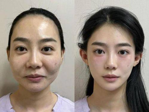 吴明真美颂福丽贝医院收费价格表/收费标准