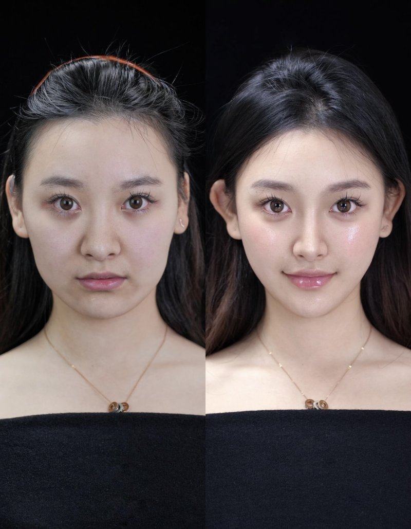 叶进医生价格表