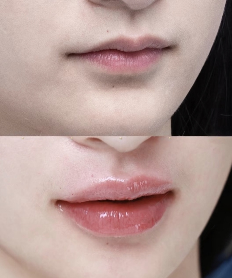 叶进医生坐诊医院