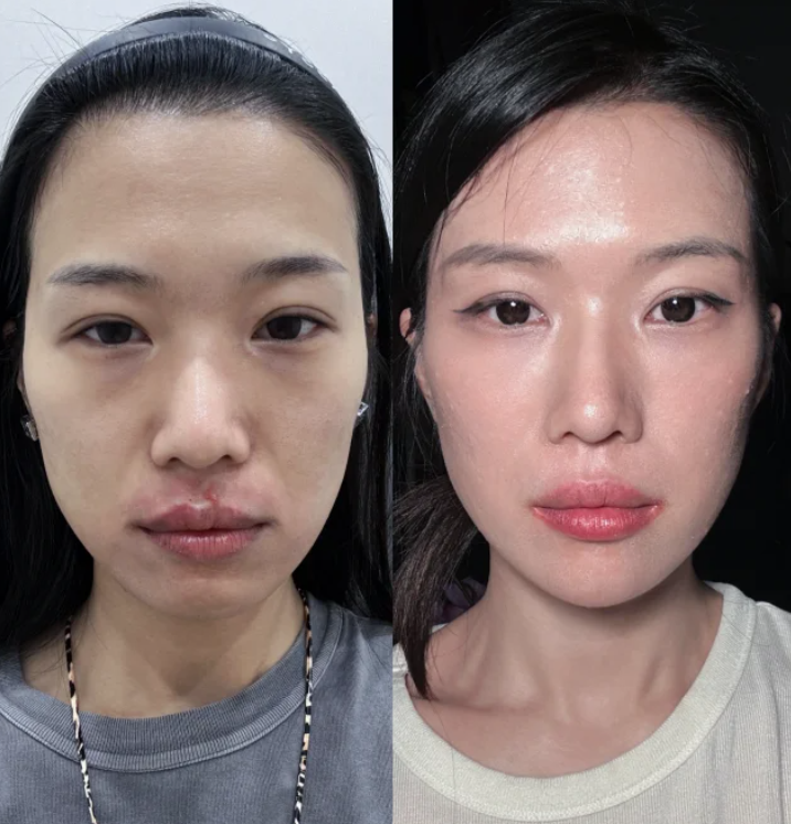 谢娟医生价格表