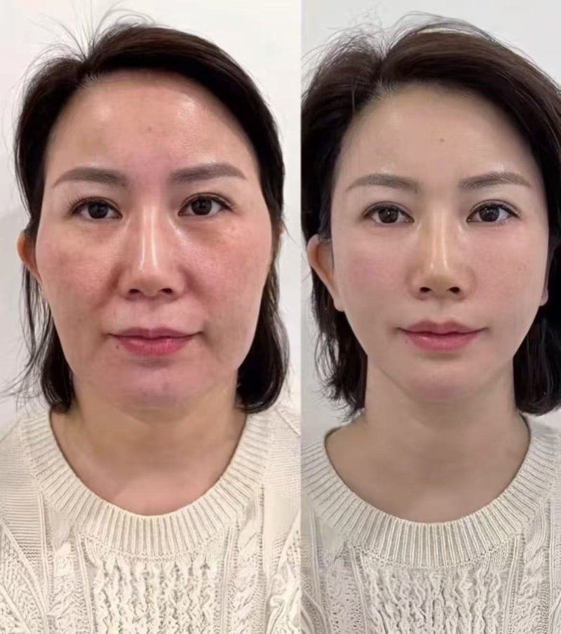 娄寅医生价格表