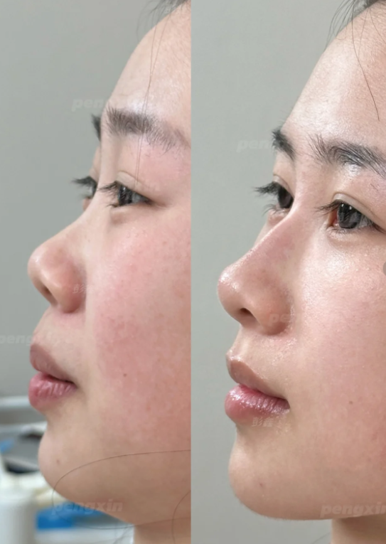 谢娟医生口碑评价及真人实例