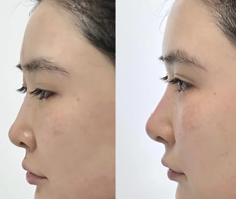 娄寅医生坐诊医院