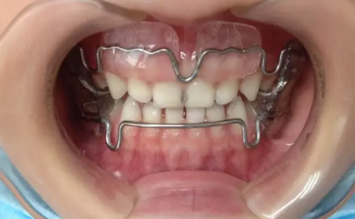 李慧平医生价格表