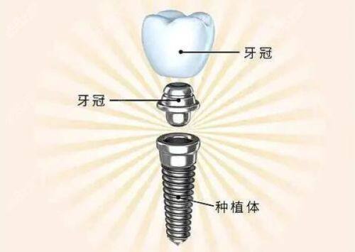 赵中华医生技术优势