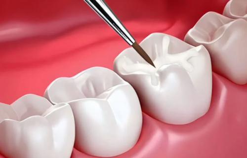 九江诺一口腔门诊部真人口碑评价怎么样？