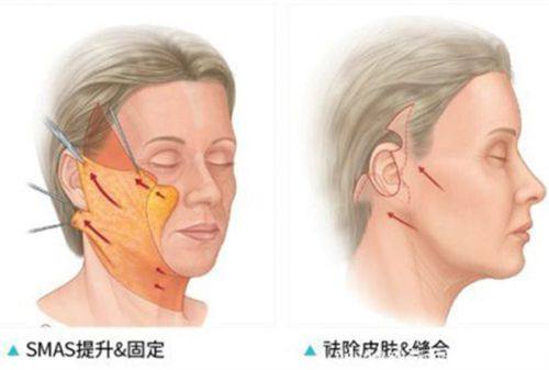 瞿维钧医生坐诊医院