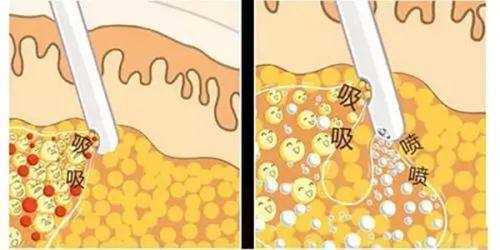 李援东医生价格表