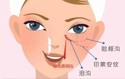 黄益锋医生坐诊医院