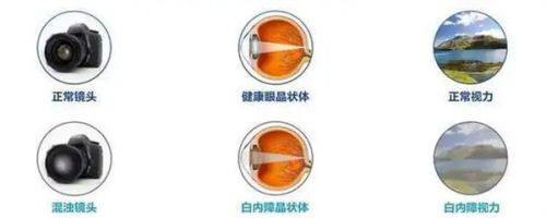 岳阳市一人民医院眼科收费价格表/收费标准