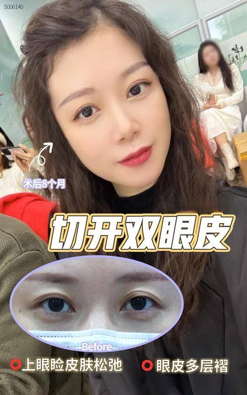 韶关奢啡整形医院是正规医院吗？