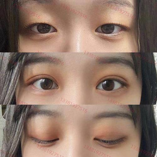 韶关奢啡整形医院特色项目及技术优势