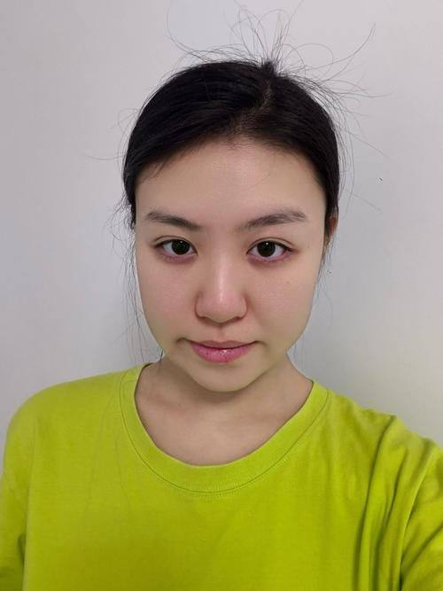 宜春华美整形医疗美容门诊部收费价格表/收费标准