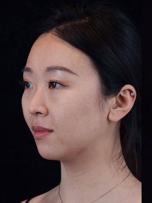 潮州博兰雅医疗美容诊所收费价格表/收费标准