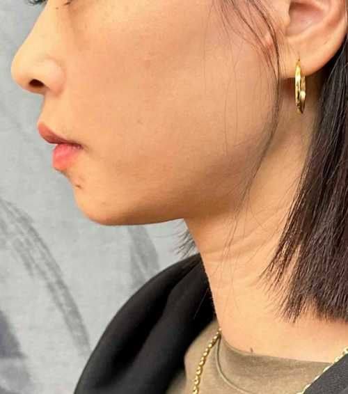 重庆肖医生医疗美容诊所收费价格表/收费标准