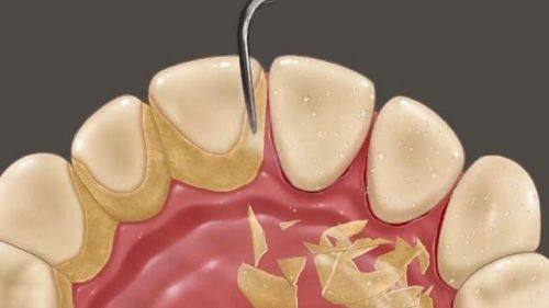 湖南长沙众鑫美学口腔真人口碑评价怎么样？