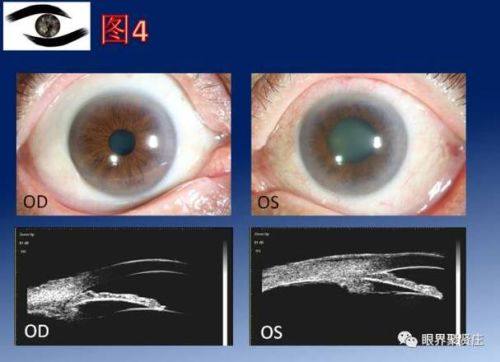 钦州市第一人民医院眼科地址电话营业时间