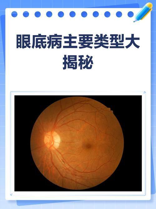 防城港市第一人民医院眼科详细的预约挂号方式及流程