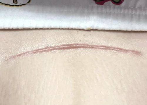 宜春华美整形医疗美容门诊部真人口碑评价怎么样？