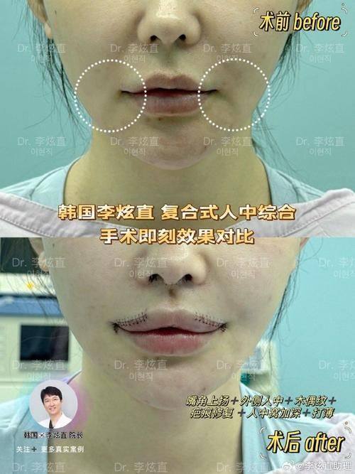 沧州富美达整形美容诊所真人口碑评价怎么样？