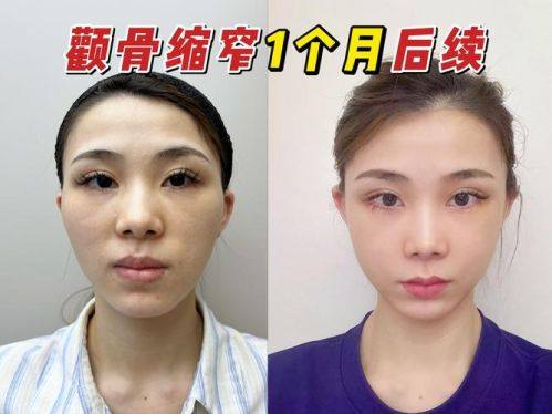 宜春华美整形医疗美容门诊部是正规医院吗？