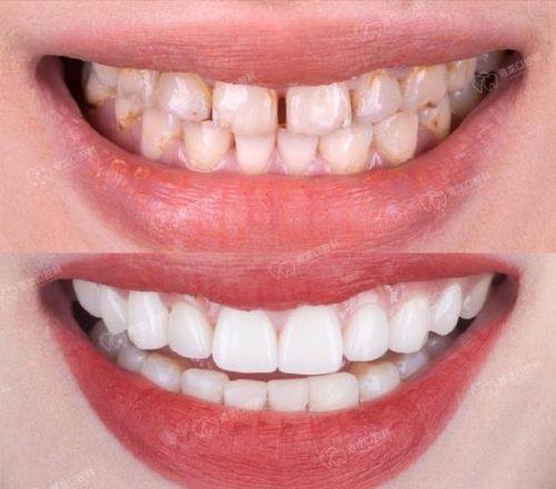 湖南长沙众鑫美学口腔地址电话营业时间