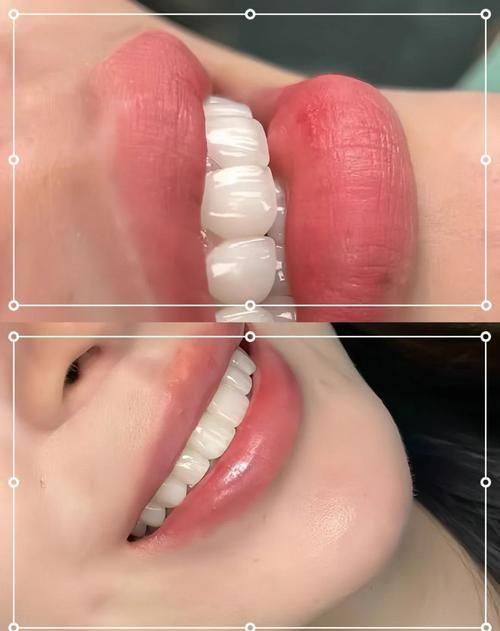 湖南长沙众鑫美学口腔特色项目及技术优势