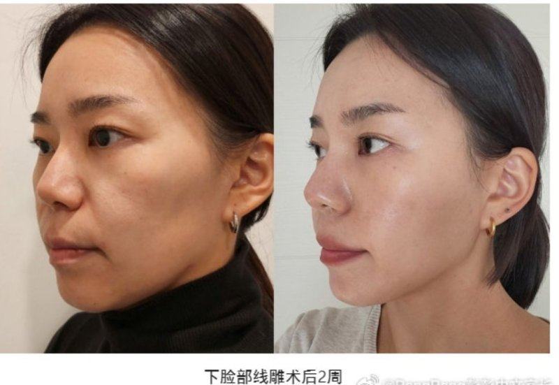 瞿维钧医生口碑评价及真人实例