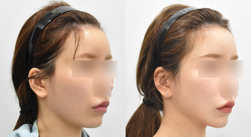 郭永信医生价格表