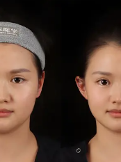 郭永信医生口碑评价及真人实例