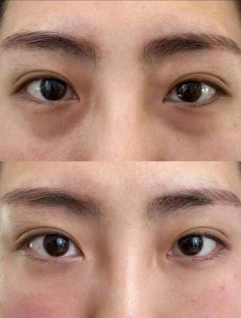 谢娟医生预约挂号