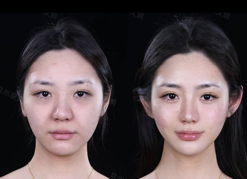 黄益锋医生技术优势