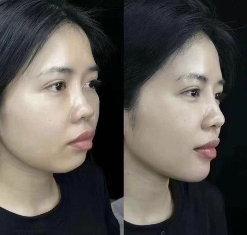 石红卫医生预约挂号