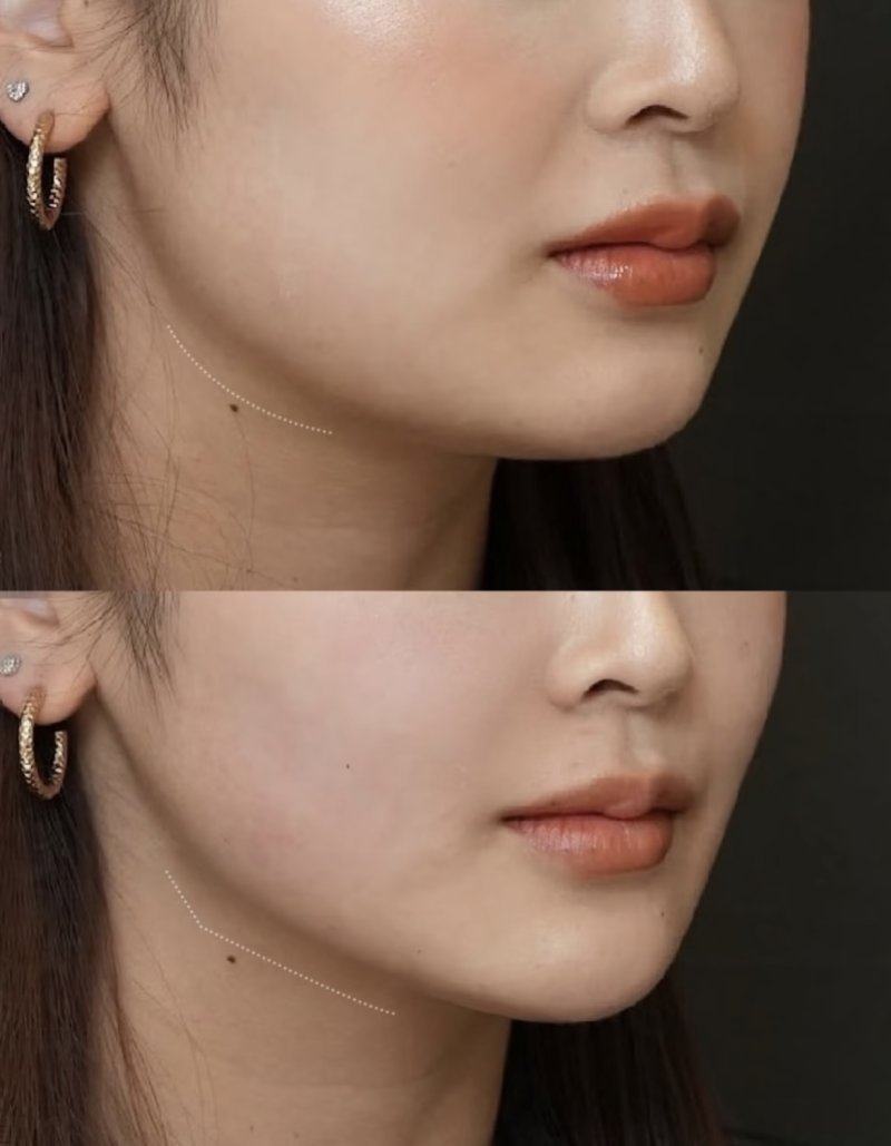 石红卫医生技术优势