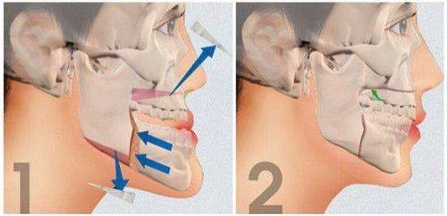 徐爱兵医生坐诊医院