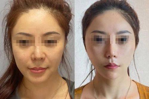 焦作陶子医疗美容诊所真人口碑评价怎么样？