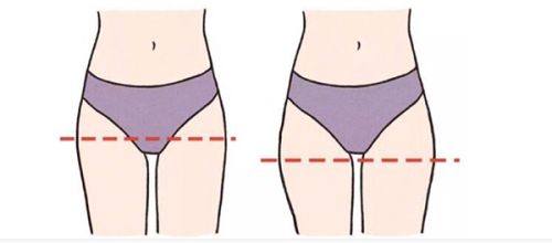 丁浩医生技术优势