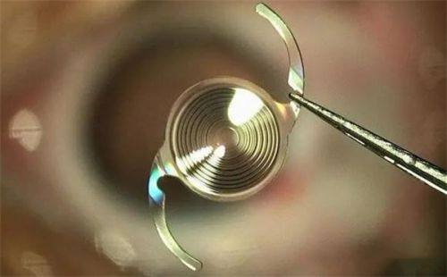 何小辉医生技术优势