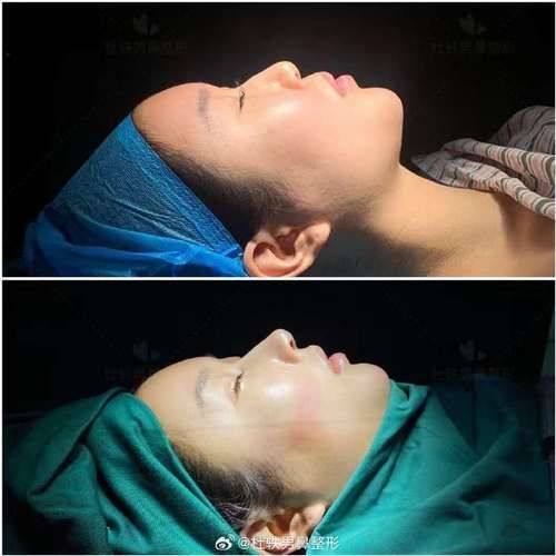 深圳李氏整形医疗美容门诊部详细的预约挂号方式及流程