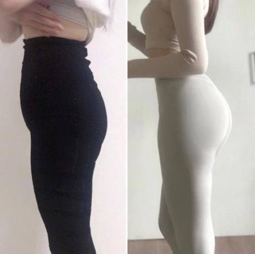 重庆妮威医疗美容医院是正规医院吗？