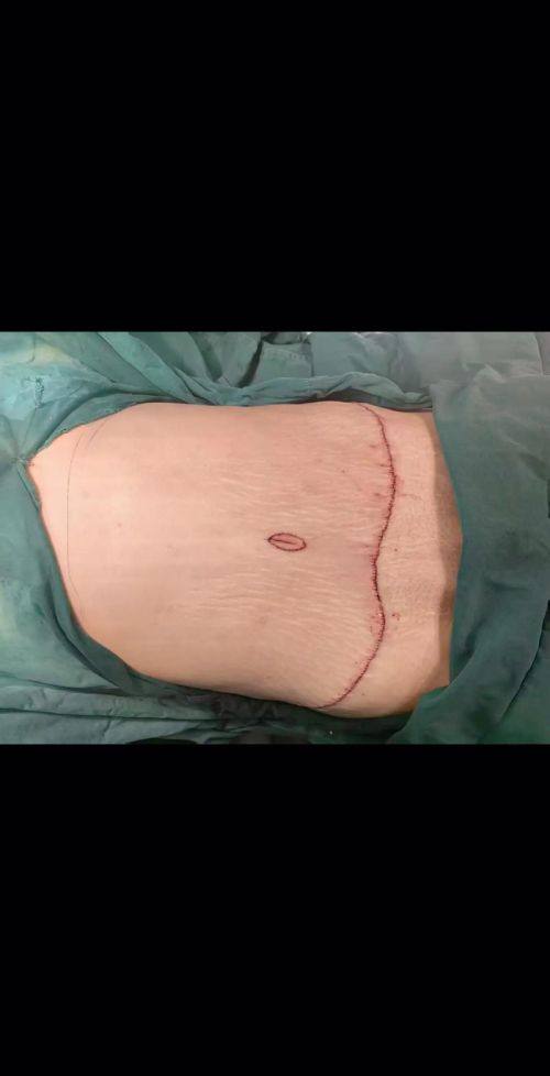 宣城仁爱医院整形烧伤外科预约挂号方式及流程