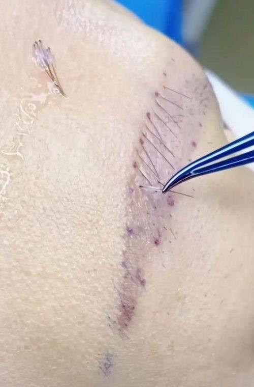 贵阳盛初植发医院简介概述