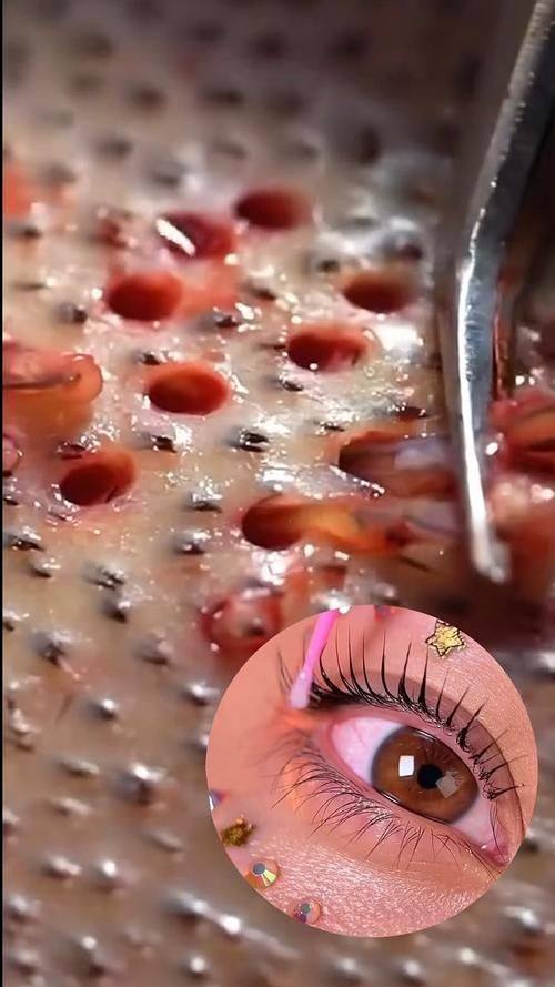 贵阳盛初植发医院收费价格表/收费标准