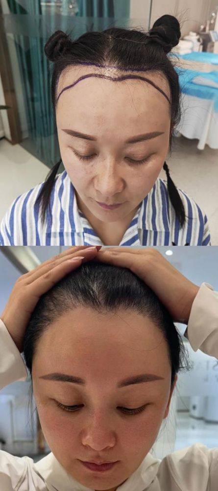 贵阳盛初植发医院是正规医院吗？