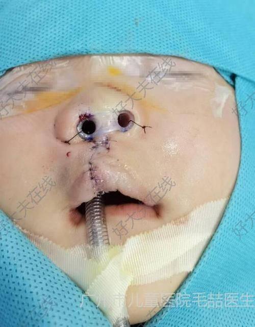 宁乡颜瑟整形医院收费价格表/收费标准