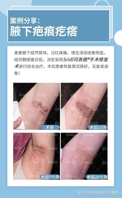 宣城仁爱医院整形烧伤外科特色项目及技术优势