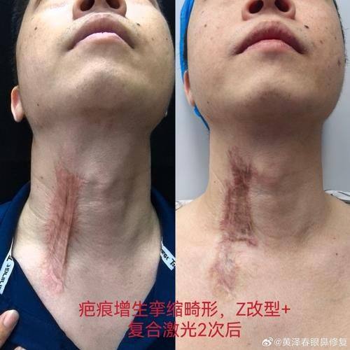 重庆妮威医疗美容医院收费价格表/收费标准