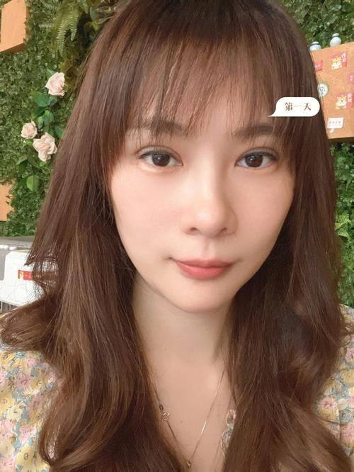 烟台知颜致丽医疗美容门诊部收费价格参考