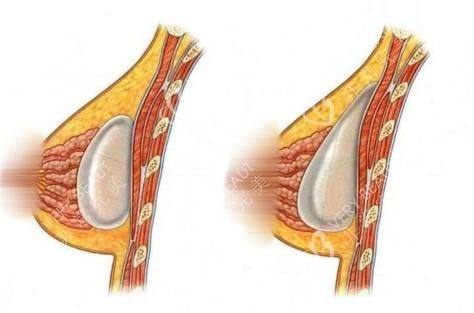 重庆妮威医疗美容医院特色项目及技术优势